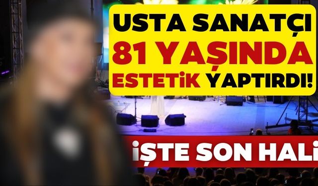 Usta sanatçı 81 yaşında estetik yaptırdı!